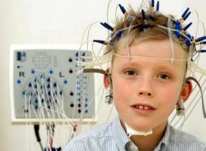 Что такое энцефалограмма головного мозга и зачем ее делают детям?