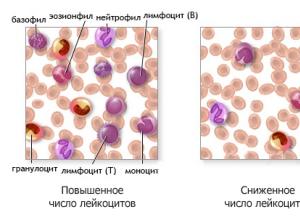 Пониженные лейкоциты в крови у женщин Способы лечения пониженных лейкоцитов